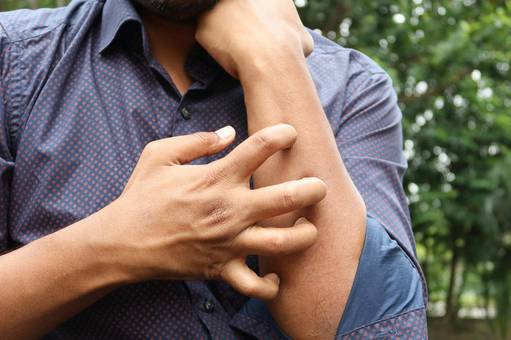A photo of a man scratching his forearm from a bug bite.
